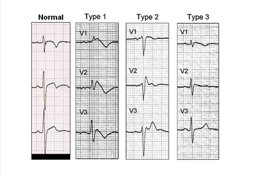 fig12.jpg